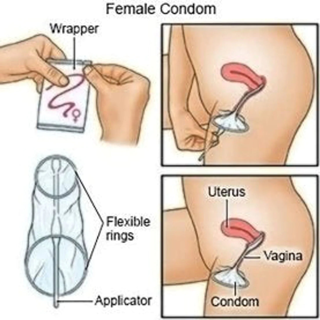 Cobra Female Condom